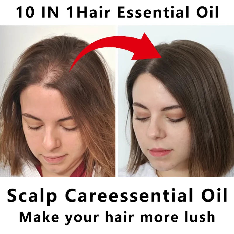 10-in-1 Castor Hair Essential Oil 100ml - Nourishing Scalp Oil with Batana, Peppermint & Biotin