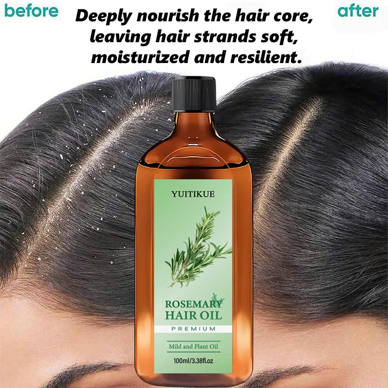 YUITIKUE Premium Rosemary Hair Oil | Mild Plant-Based Formula | For Gentle Hair & Scalp Nourishment & Healthy Hair Care 100ml