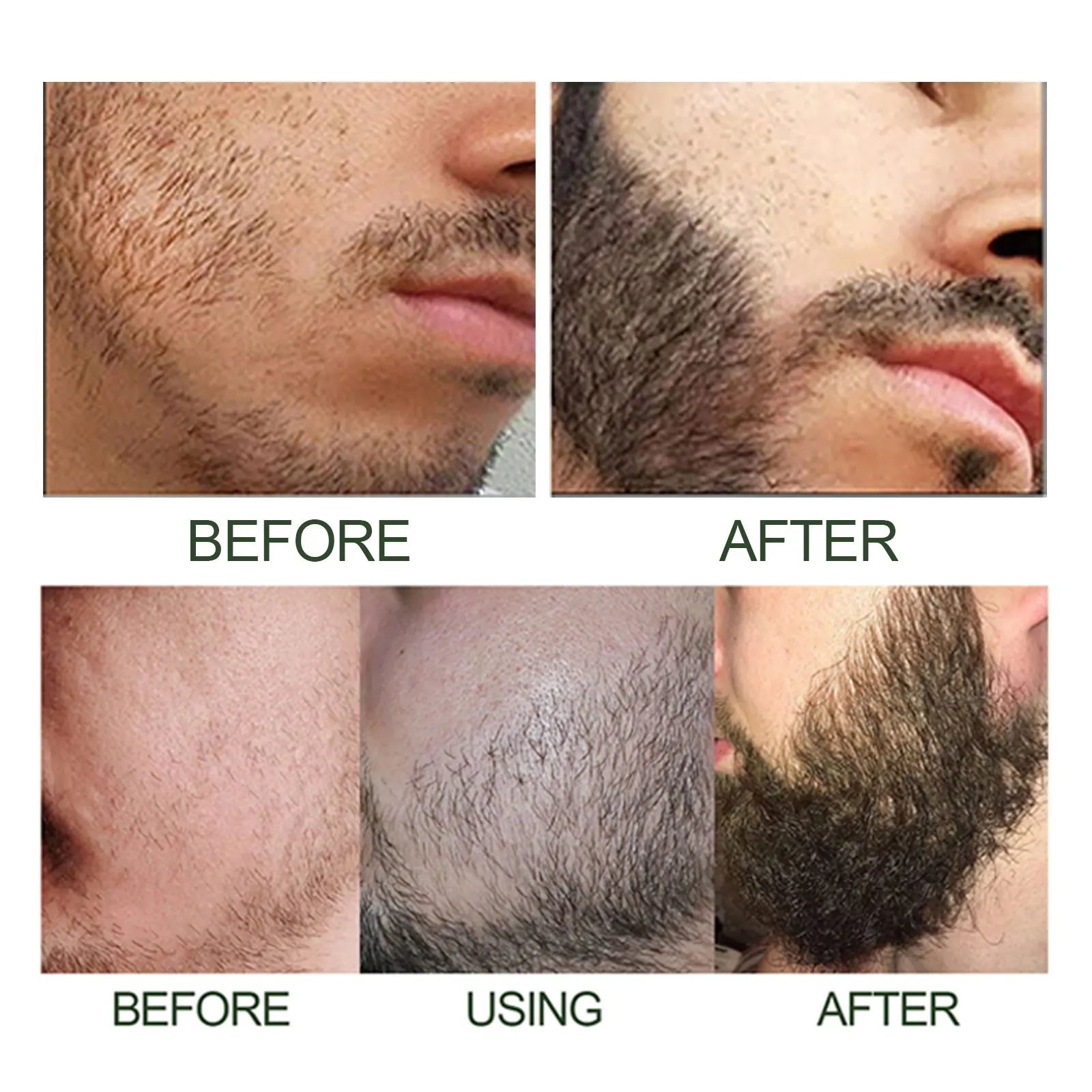 Beard Care Essence Set Men's Facial Care Hair Nutrition Beard Care